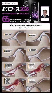 TMJ from normal to the end stages
