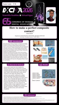 How to make a perfect composite contact?